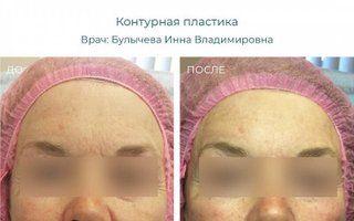 Портфолио